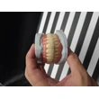 IMPLANT PROSTHESIS