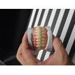 IMPLANT PROSTHESIS