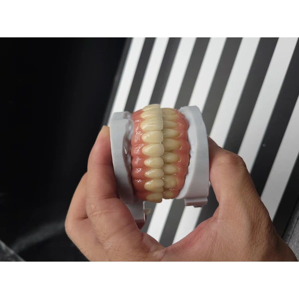 IMPLANT PROSTHESIS