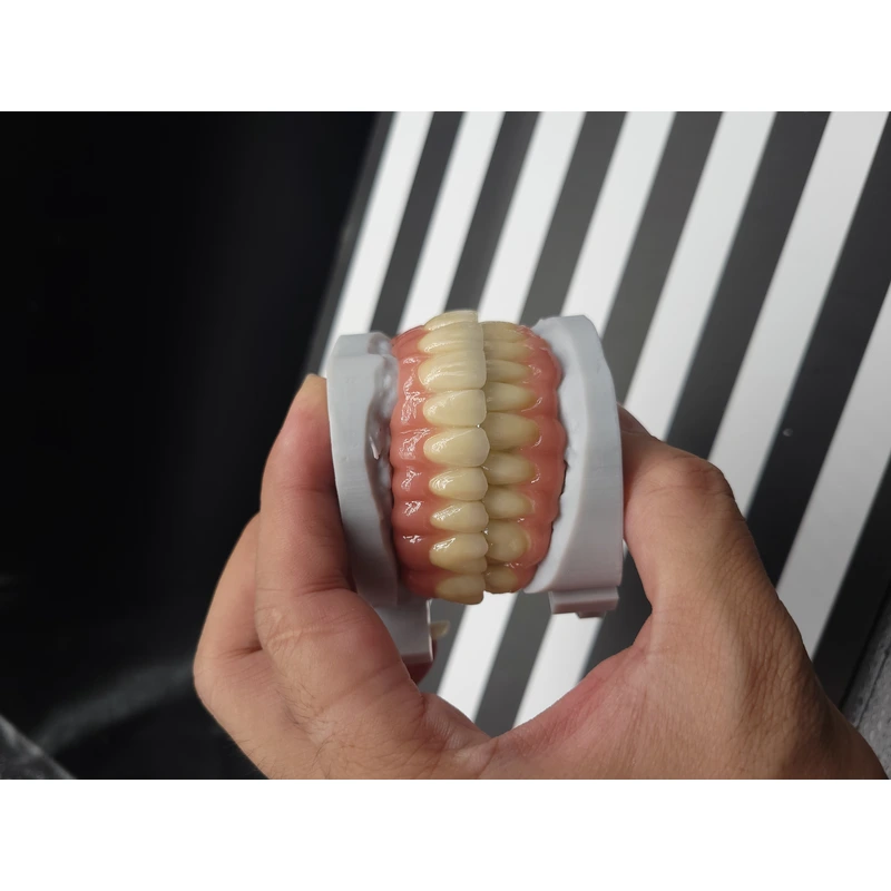 IMPLANT PROSTHESIS