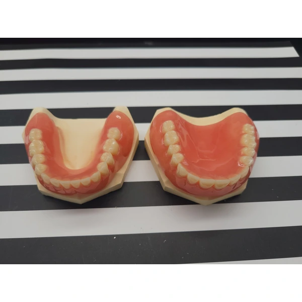 Acrylic/Valplast Denture