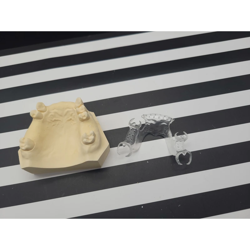 Clear Framework Denture
