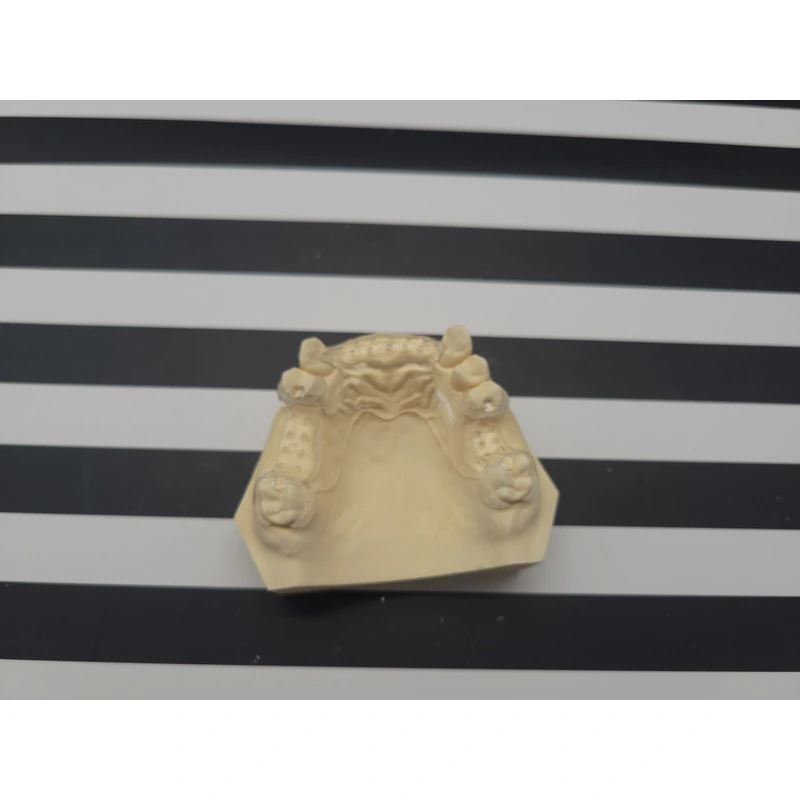 Clear Framework Denture