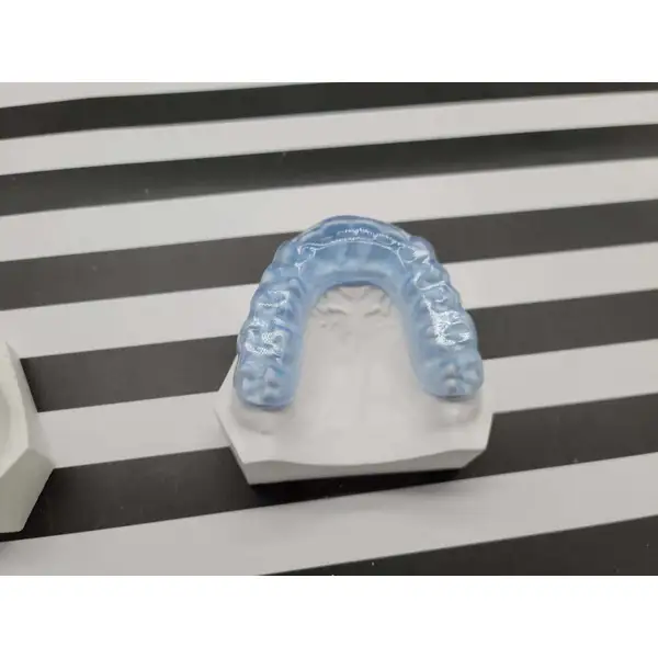 Night grinding braces provided