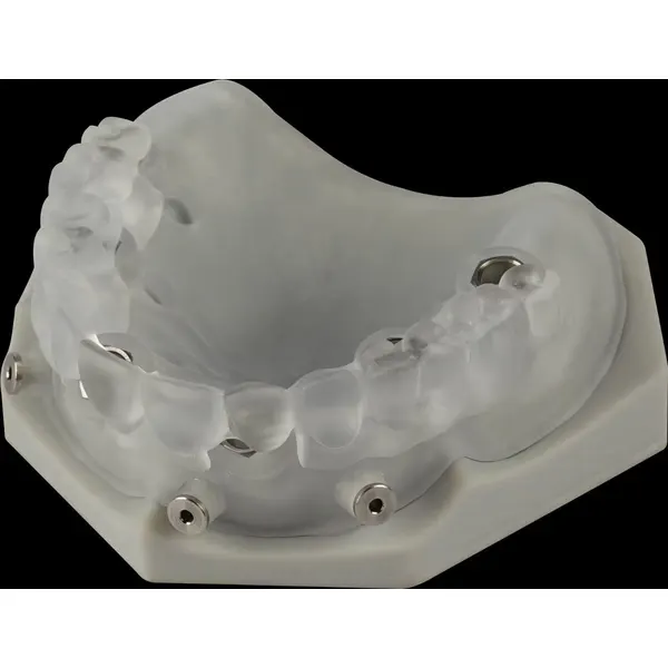 MicroDental Surgical Guide