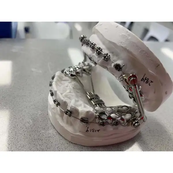 China Herbst Appliance