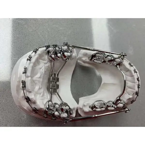 China Herbst Appliance