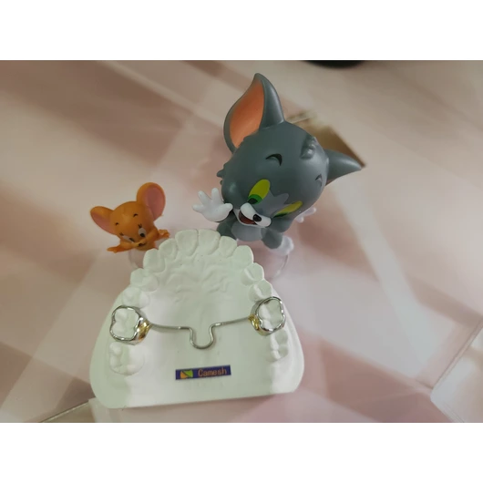 Trans-Palatal Arch (TPA)