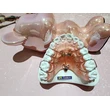 Chinese orthodontics