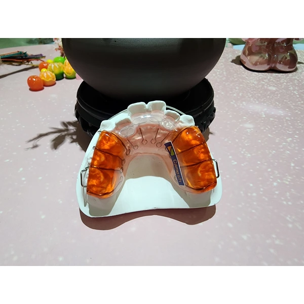 Chinese orthodontics