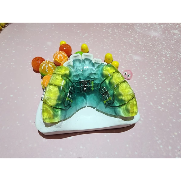 Chinese orthodontics