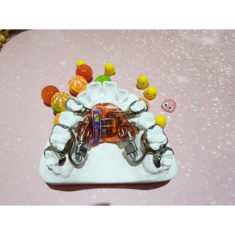 Chinese orthodontics