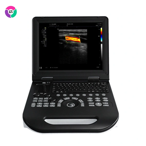Portable Color Doppler Ultrasound Echocardiogram Machine Reusable for Large Animal Including Dogs for Echocardiography
