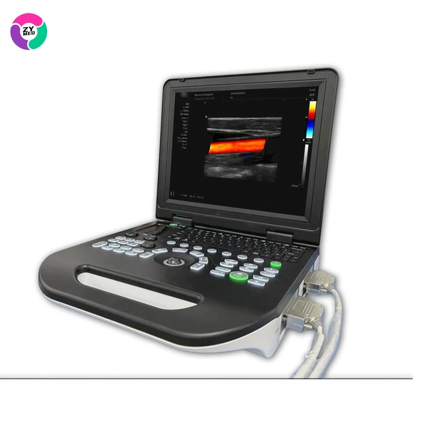 Portable Color Doppler Ultrasound Echocardiogram Machine Reusable for Large Animal Including Dogs for Echocardiography